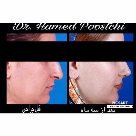 عکس های دکتر حامد پوستچی عکس های دکتر حامد پوستچی