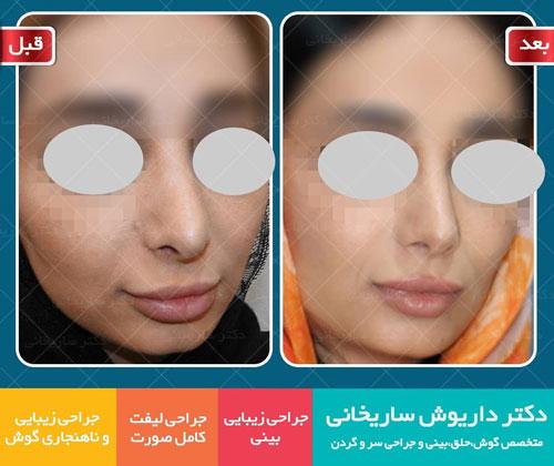 Photo ofDr. Dariush Sarikhani  Photo ofDr. Dariush Sarikhani