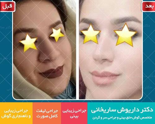 Photo ofDr. Dariush Sarikhani  Photo ofDr. Dariush Sarikhani