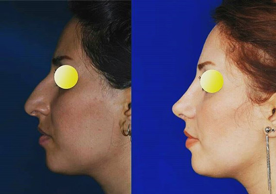 عکس های دکتر سعید مرزبان عکس های دکتر سعید مرزبان