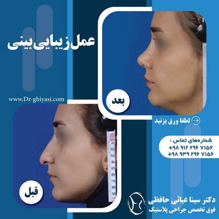 Photo ofDr. Sina Ghiyasi Hafezi Photo ofDr. Sina Ghiyasi Hafezi