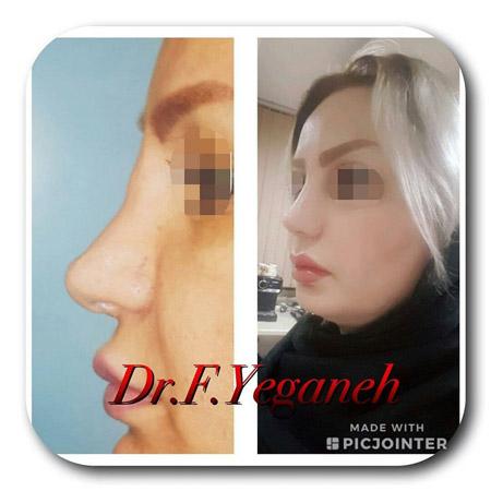 Photo ofDr. Firooze Yeganeh  Photo ofDr. Firooze Yeganeh