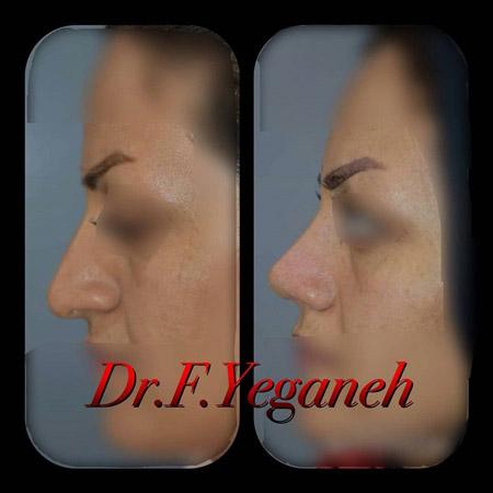 Photo ofDr. Firooze Yeganeh  Photo ofDr. Firooze Yeganeh