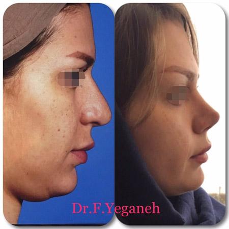 Photo ofDr. Firooze Yeganeh  Photo ofDr. Firooze Yeganeh