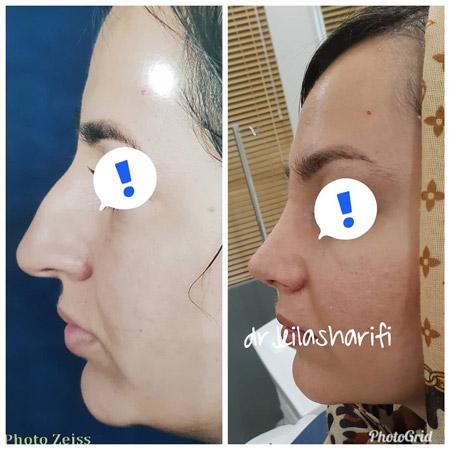 عکس های دکتر لیلا شریفی عکس های دکتر لیلا شریفی