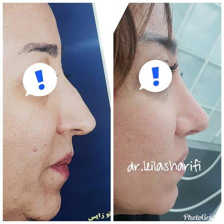 عکس های دکتر لیلا شریفی عکس های دکتر لیلا شریفی