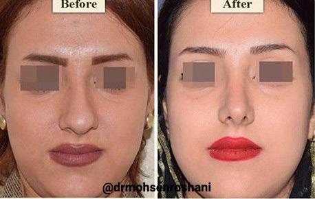 عکس های دکتر محسن روشنی عکس های دکتر محسن روشنی