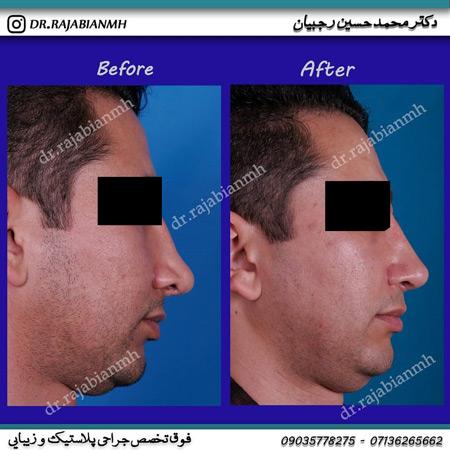 عکس های دکتر محمد حسین رجبیان عکس های دکتر محمد حسین رجبیان