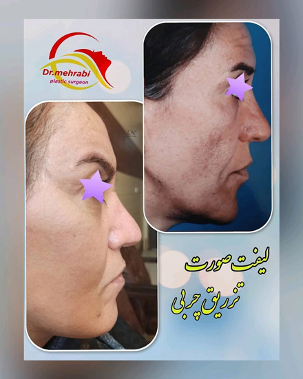 عکس های دکتر محمد مهدی مهرابی عکس های دکتر محمد مهدی مهرابی