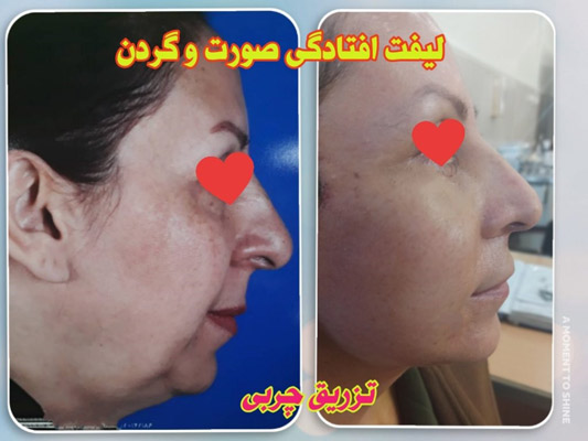 عکس های دکتر محمد مهدی مهرابی عکس های دکتر محمد مهدی مهرابی