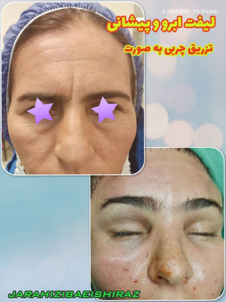 عکس های دکتر محمد مهدی مهرابی عکس های دکتر محمد مهدی مهرابی