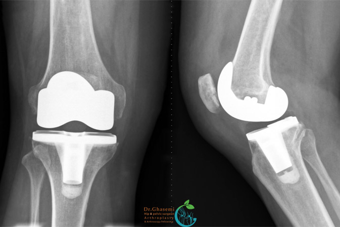 عکس های دکتر محمد علی قاسمی عکس های دکتر محمد علی قاسمی