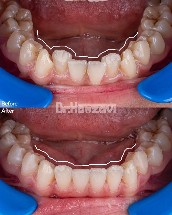 عکس های کلینیک دندانپزشکی دکتر حمزوی عکس های کلینیک دندانپزشکی دکتر حمزوی