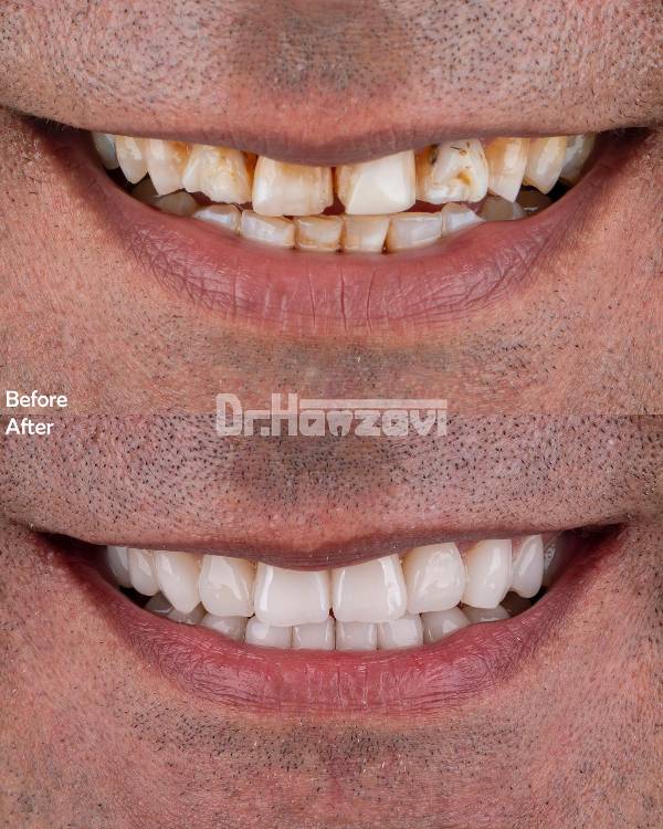 عکس های کلینیک دندانپزشکی دکتر حمزوی عکس های کلینیک دندانپزشکی دکتر حمزوی