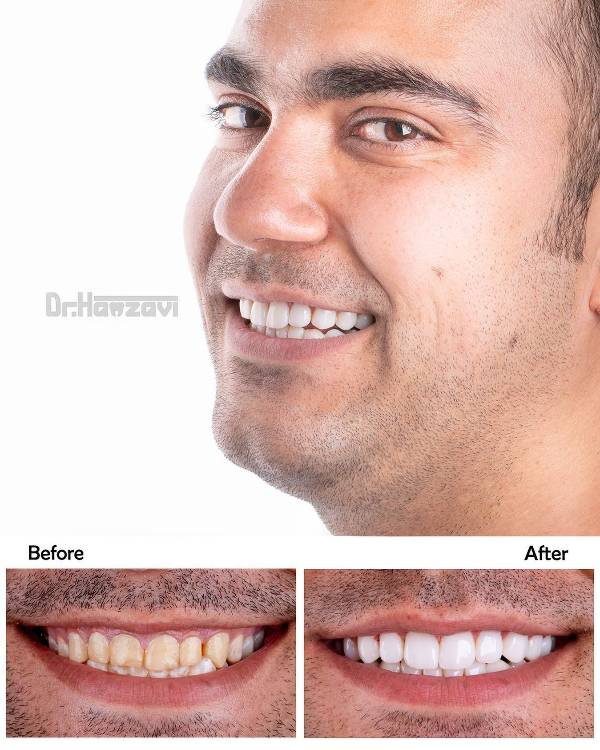 عکس های کلینیک دندانپزشکی دکتر حمزوی عکس های کلینیک دندانپزشکی دکتر حمزوی