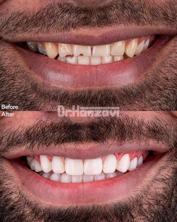 عکس های کلینیک دندانپزشکی دکتر حمزوی عکس های کلینیک دندانپزشکی دکتر حمزوی