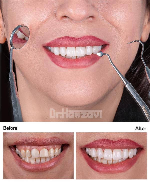 عکس های کلینیک دندانپزشکی دکتر حمزوی عکس های کلینیک دندانپزشکی دکتر حمزوی