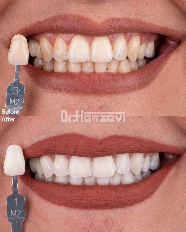 عکس های کلینیک دندانپزشکی دکتر حمزوی عکس های کلینیک دندانپزشکی دکتر حمزوی