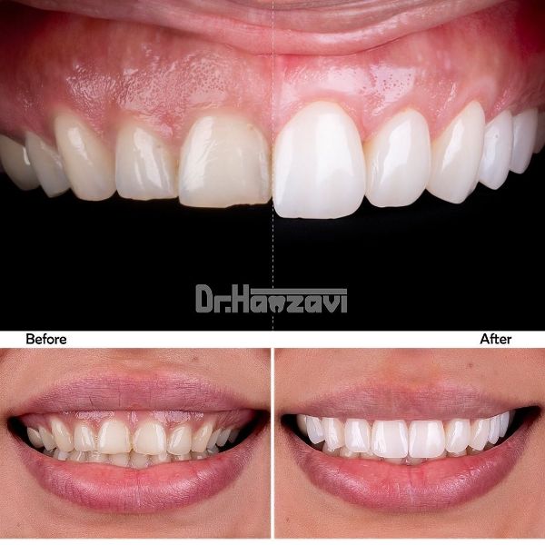 عکس های کلینیک دندانپزشکی دکتر حمزوی عکس های کلینیک دندانپزشکی دکتر حمزوی