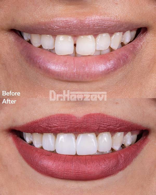 عکس های کلینیک دندانپزشکی دکتر حمزوی عکس های کلینیک دندانپزشکی دکتر حمزوی