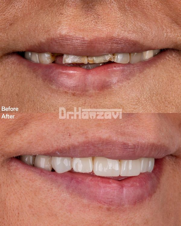 عکس های کلینیک دندانپزشکی دکتر حمزوی عکس های کلینیک دندانپزشکی دکتر حمزوی