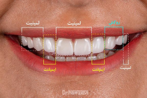 عکس های کلینیک دندانپزشکی دکتر حمزوی عکس های کلینیک دندانپزشکی دکتر حمزوی