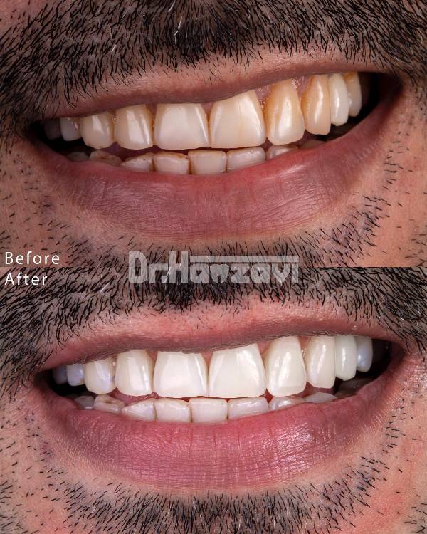 عکس های کلینیک دندانپزشکی دکتر حمزوی عکس های کلینیک دندانپزشکی دکتر حمزوی