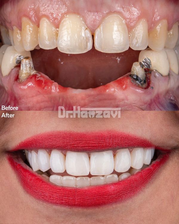 عکس های کلینیک دندانپزشکی دکتر حمزوی عکس های کلینیک دندانپزشکی دکتر حمزوی