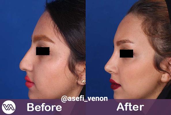 Photo ofDr. Venon Asefi  Photo ofDr. Venon Asefi