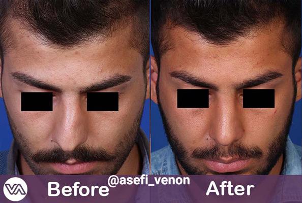 Photo ofDr. Venon Asefi  Photo ofDr. Venon Asefi