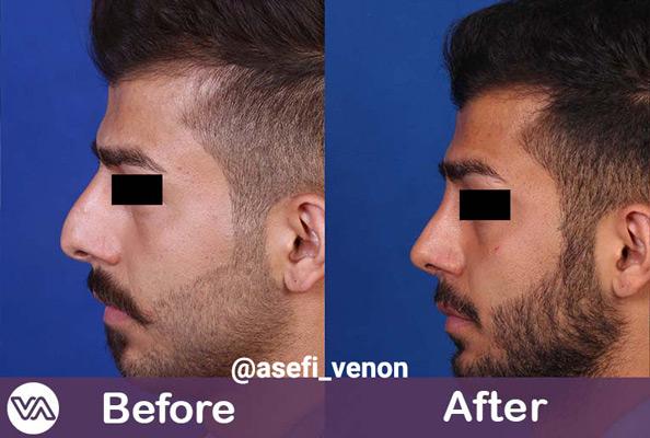 Photo ofDr. Venon Asefi  Photo ofDr. Venon Asefi