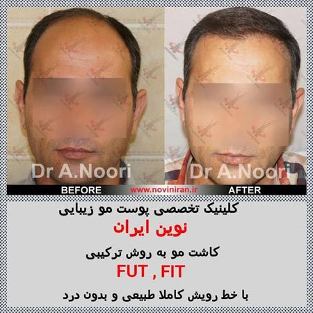 عکس های كلينيک نوین ایران عکس های كلينيک نوین ایران