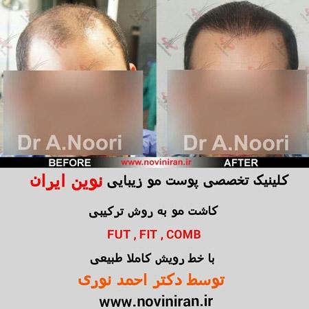 عکس های كلينيک نوین ایران عکس های كلينيک نوین ایران