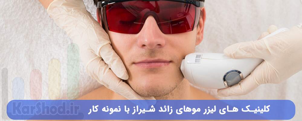 کلینیک های لیزر موهای زائد شیراز با نمونه کار