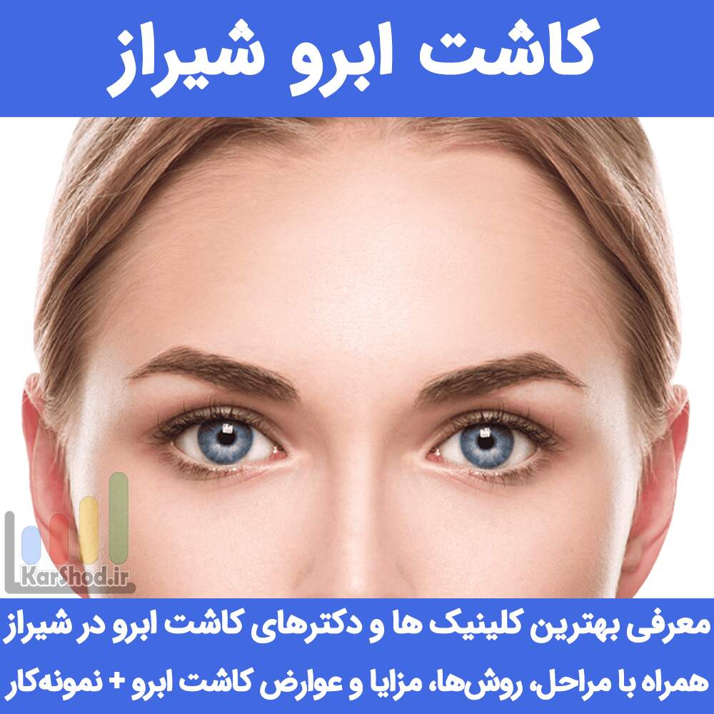 کاشت ابرو شیراز