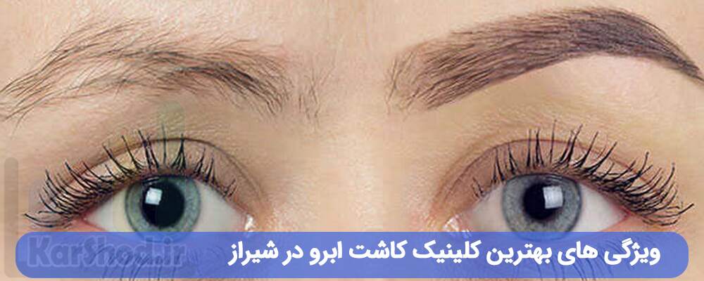 ویژگی بهترین کلینیک کاشت ابرو در شیراز