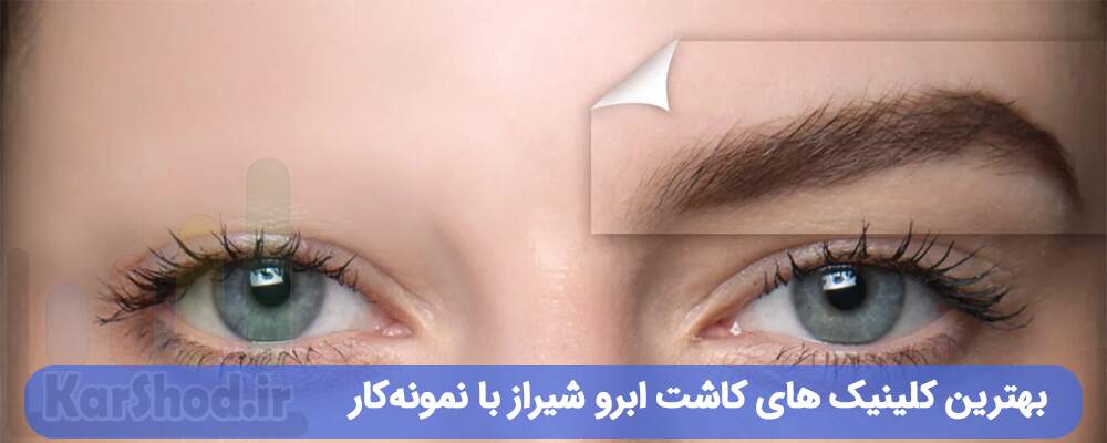 بهترین کلینیک های کاشت ابرو شیراز