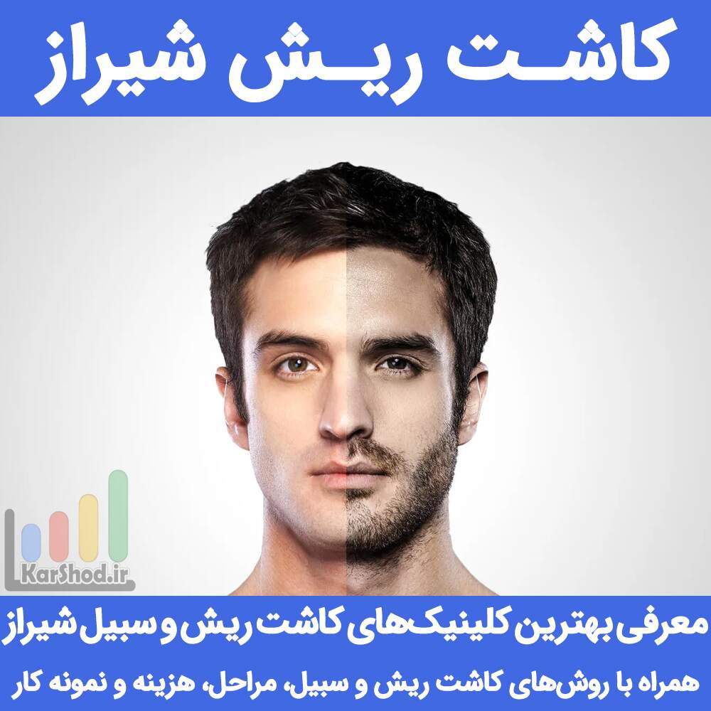 کاشت ریش شیراز