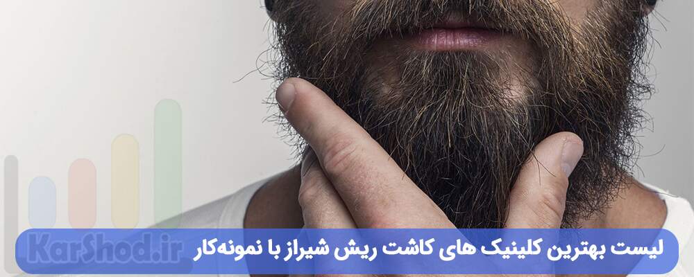 لیست بهترین کلینیک های کاشت ریش شیراز