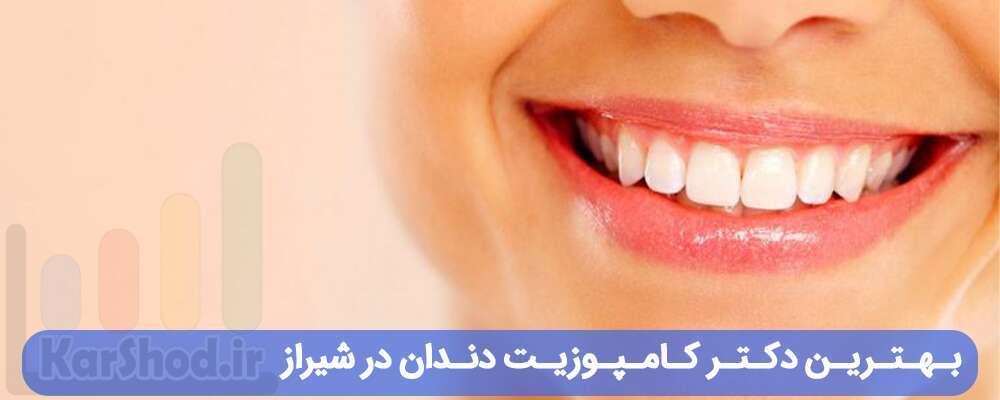بهترین دکتر کامپوزیت دندان در شیراز