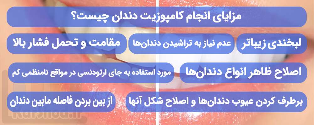 مزایای انجام کامپوزیت دندان چیست؟