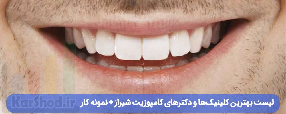 لیست بهترین کلینیک‌ها و دکترهای کامپوزیت شیراز
