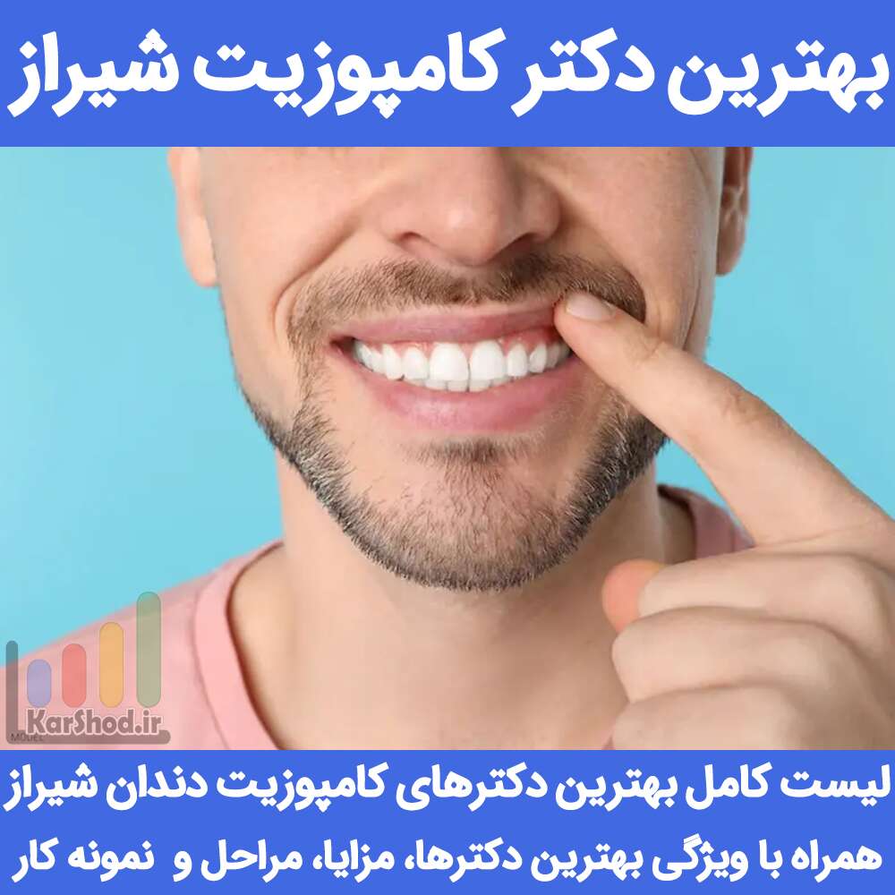بهترین دکتر کامپوزیت شیراز