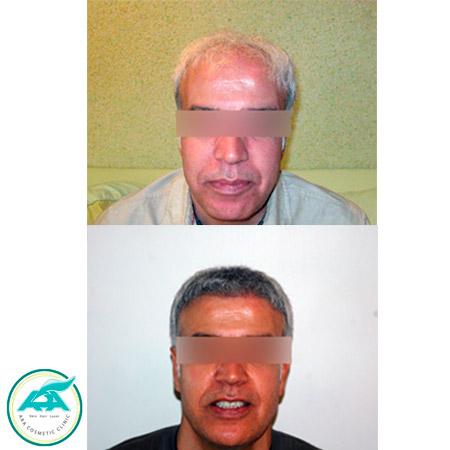 الصور عيادة آرا شیراز الصور عيادة آرا شیراز