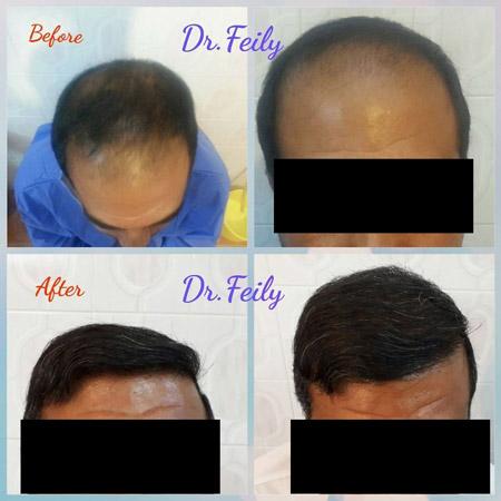 عکس های کلینیک زیبایی دکتر فیلی عکس های کلینیک زیبایی دکتر فیلی