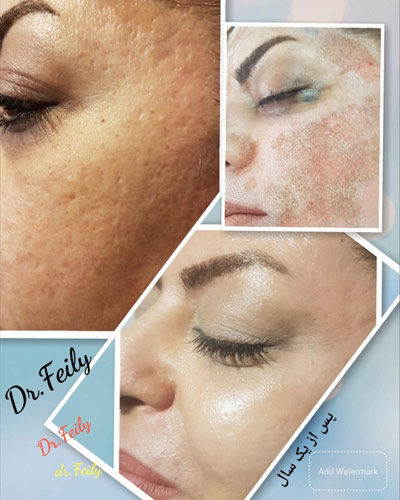 عکس های کلینیک زیبایی دکتر فیلی عکس های کلینیک زیبایی دکتر فیلی