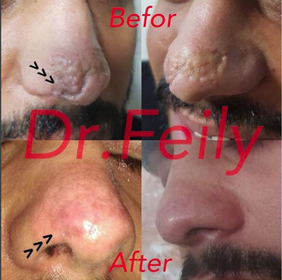 عکس های کلینیک زیبایی دکتر فیلی عکس های کلینیک زیبایی دکتر فیلی