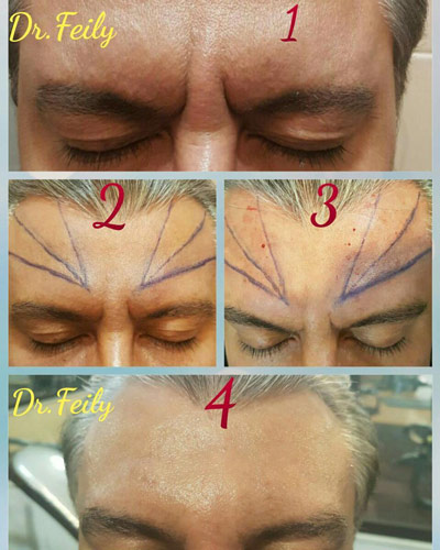 عکس های کلینیک زیبایی دکتر فیلی عکس های کلینیک زیبایی دکتر فیلی