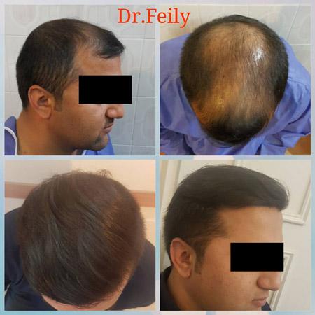 عکس های کلینیک زیبایی دکتر فیلی عکس های کلینیک زیبایی دکتر فیلی