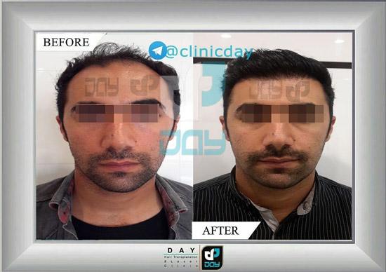 الصور عیادة الدی شیراز الصور عیادة الدی شیراز